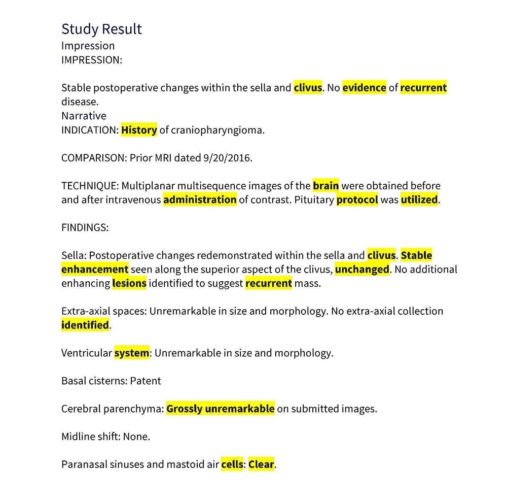 Positive Mri MRI Results: Negative Equals Positive | Francis DiClemente